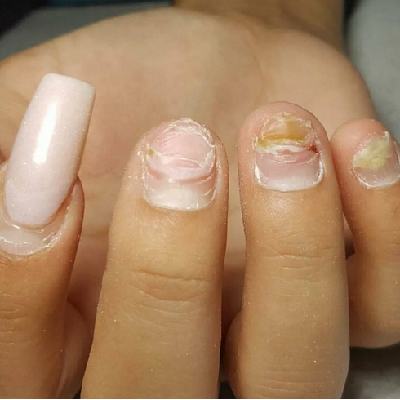 Как популярная процедура для ногтей портит их?!